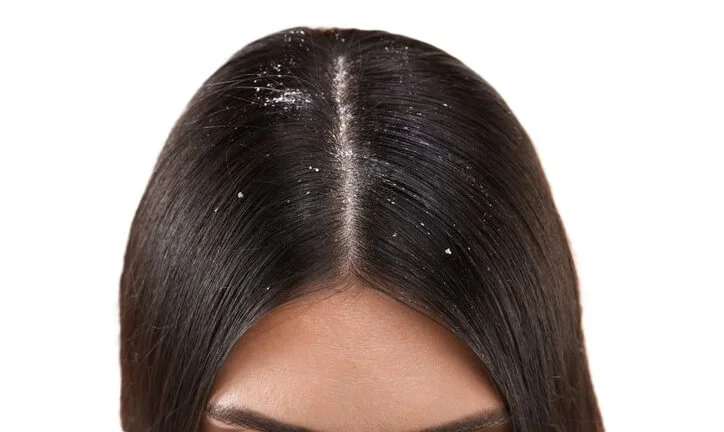 what does build up look like in hair